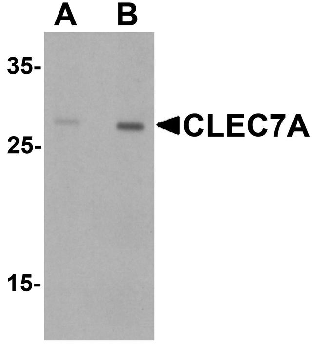 Dectin 1 Antibody in Western Blot (WB)