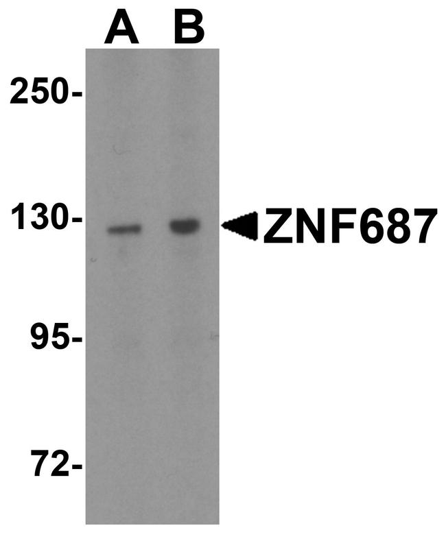 ZNF687 Antibody in Western Blot (WB)