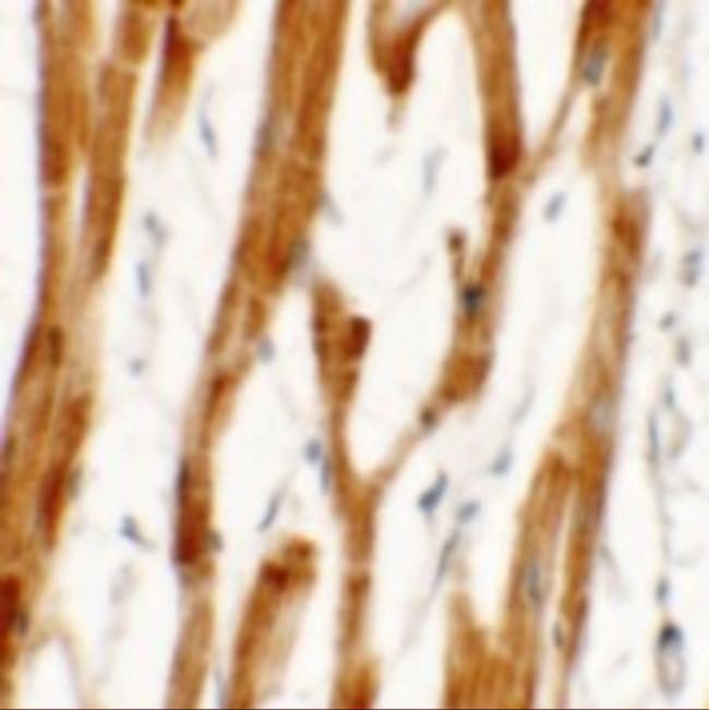 FCHO2 Antibody in Immunohistochemistry (IHC)