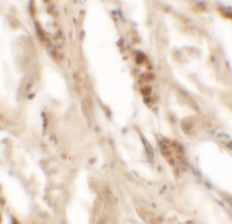 DBX2 Antibody in Immunohistochemistry (IHC)