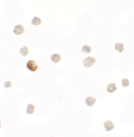 SDHAF1 Antibody in Immunocytochemistry (ICC/IF)