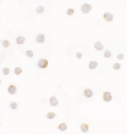 ABCA7 Antibody in Immunocytochemistry (ICC/IF)