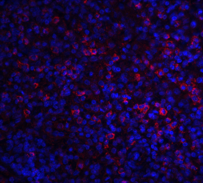 ABCA7 Antibody in Immunohistochemistry (IHC)