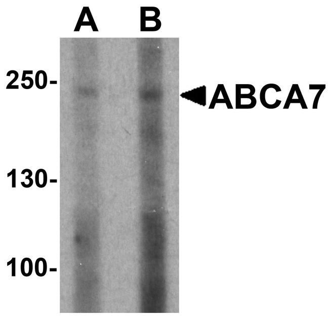 ABCA7 Antibody in Western Blot (WB)