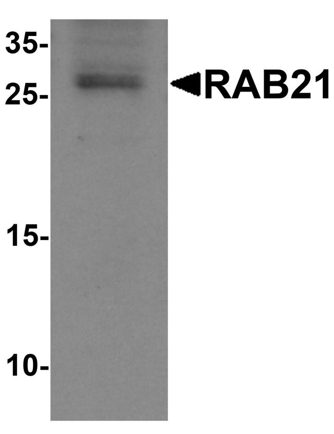 RAB21 Antibody in Western Blot (WB)