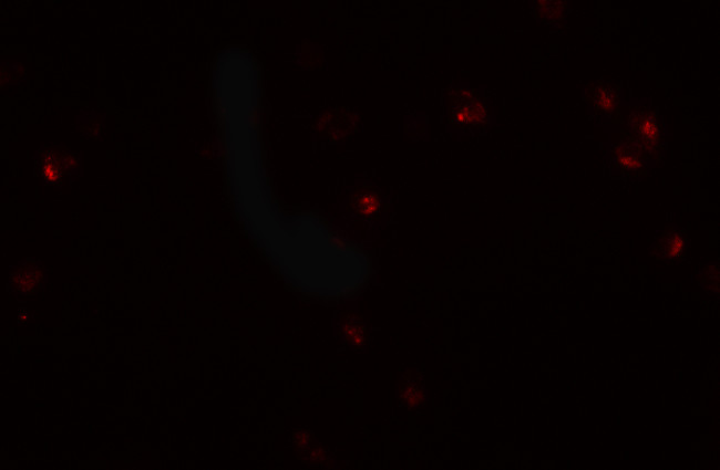 CRIM1 Antibody in Immunocytochemistry (ICC/IF)