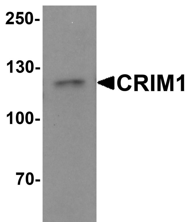 CRIM1 Antibody in Western Blot (WB)