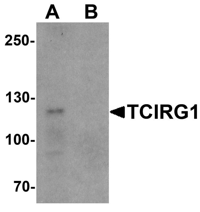 TCIRG1 Antibody in Western Blot (WB)