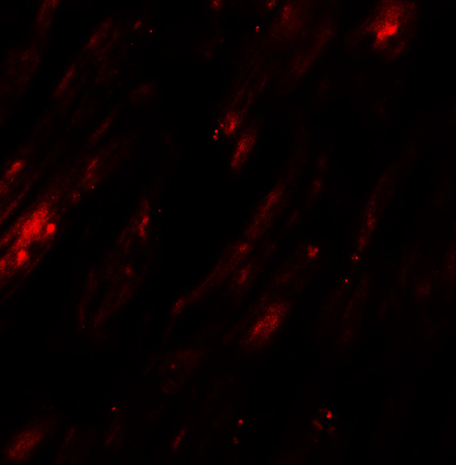 SELK Antibody in Immunohistochemistry (IHC)