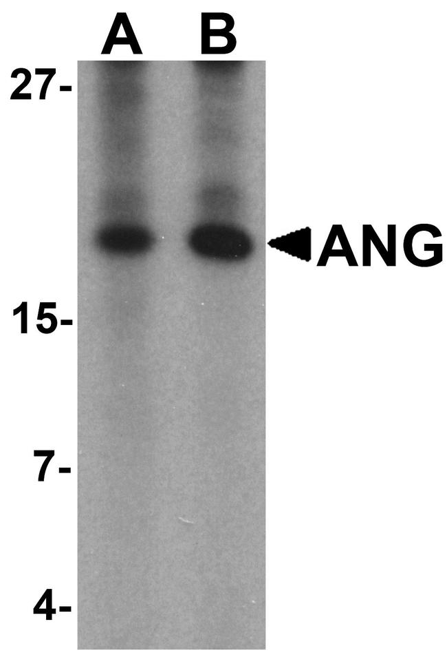Angiogenin Antibody in Western Blot (WB)