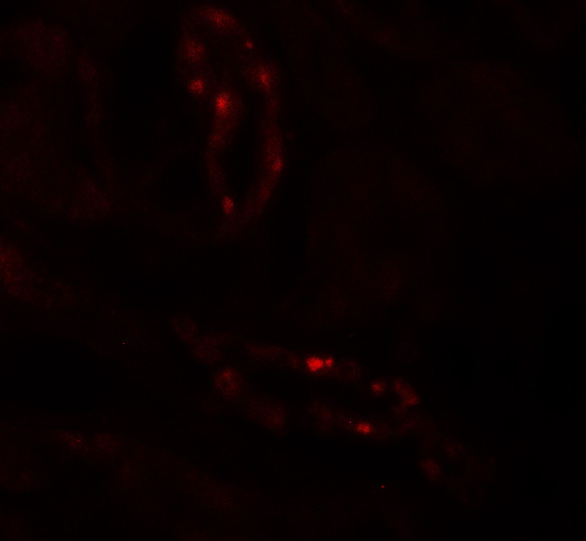 SCUBE3 Antibody in Immunohistochemistry (IHC)