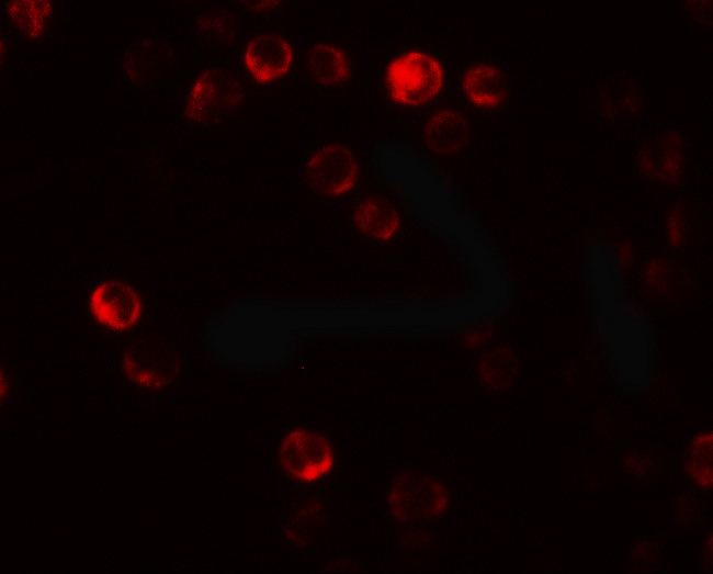 ATG2B Antibody in Immunocytochemistry (ICC/IF)