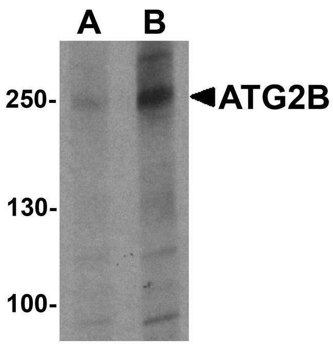 ATG2B Antibody in Western Blot (WB)