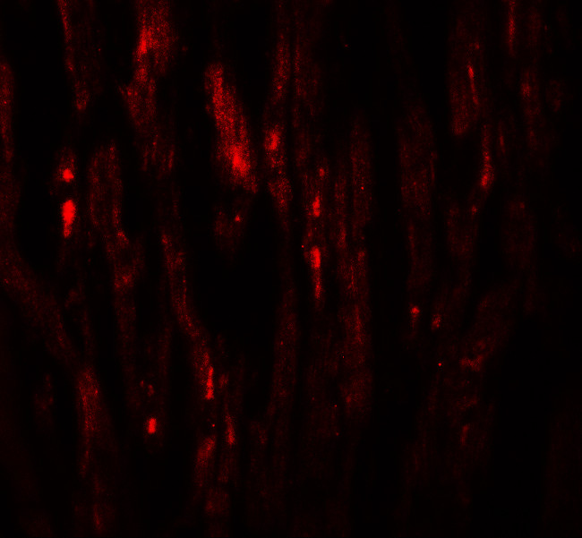 EED Antibody in Immunohistochemistry (IHC)