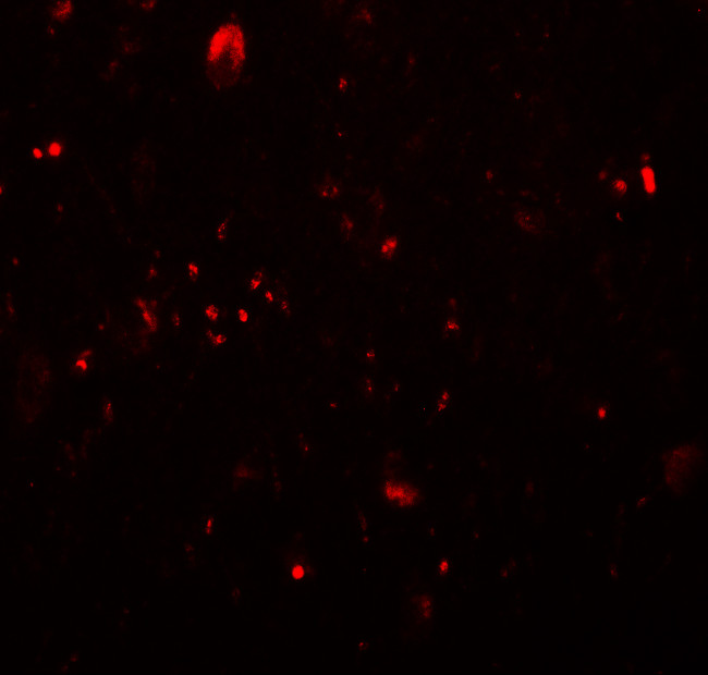 TET3 Antibody in Immunohistochemistry (IHC)