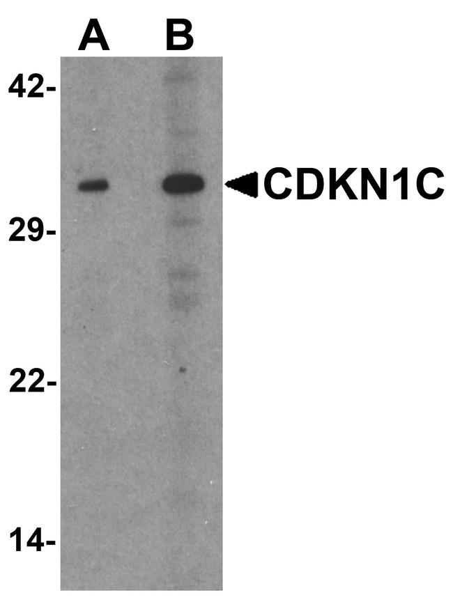 p57 Kip2 Antibody in Western Blot (WB)