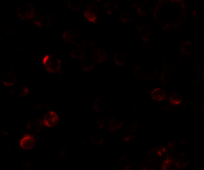 EPM2A Antibody in Immunocytochemistry (ICC/IF)