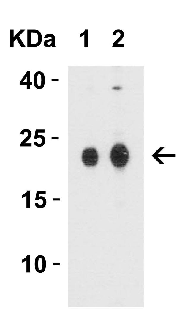 Claudin 4 Antibody in Western Blot (WB)