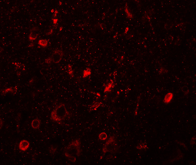 SGSM1 Antibody in Immunohistochemistry (IHC)