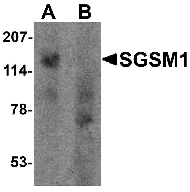 SGSM1 Antibody in Western Blot (WB)