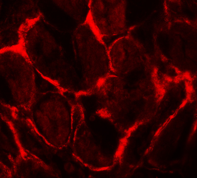 FLT3 Antibody in Immunohistochemistry (IHC)