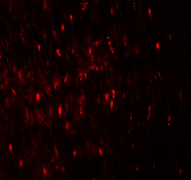 WIPI1 Antibody in Immunohistochemistry (IHC)