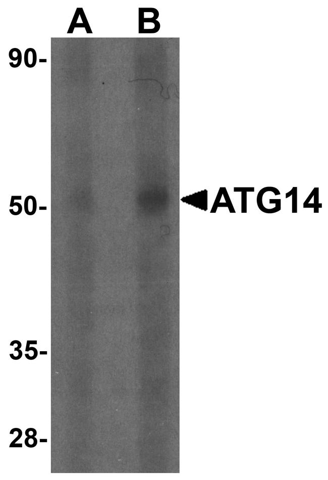 ATG14 Antibody in Western Blot (WB)