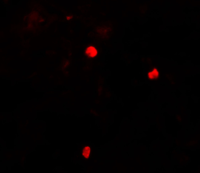 KEAP1 Antibody in Immunohistochemistry (PFA fixed) (IHC (PFA))