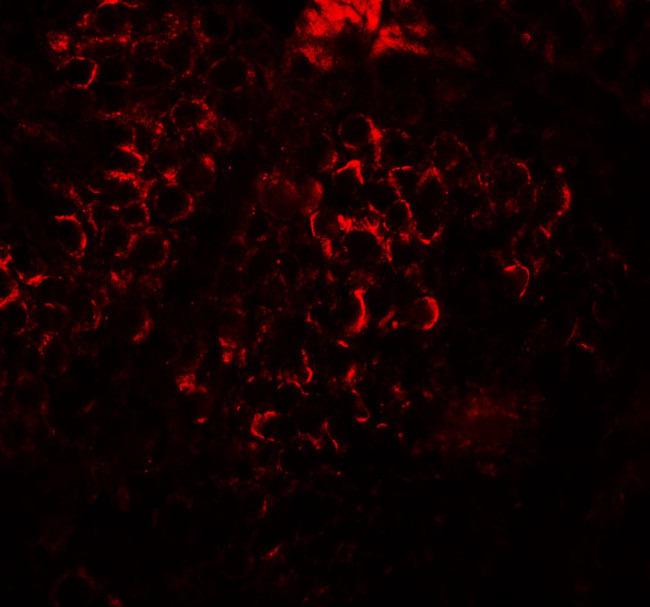 DCP2 Antibody in Immunohistochemistry (IHC)