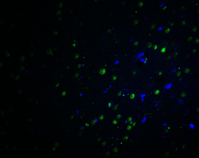 PLAGL2 Antibody in Immunohistochemistry (IHC)