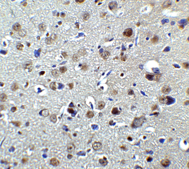 PLAGL2 Antibody in Immunohistochemistry (IHC)