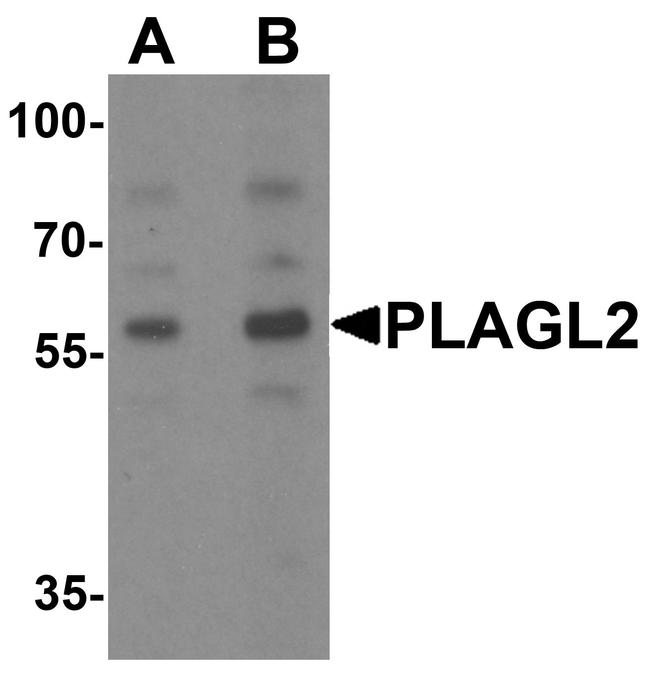 PLAGL2 Antibody in Western Blot (WB)