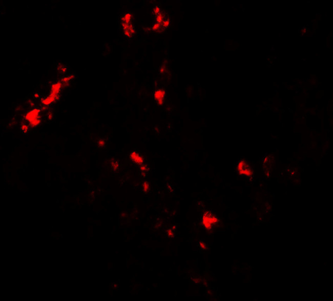 CMPK2 Antibody in Immunohistochemistry (IHC)