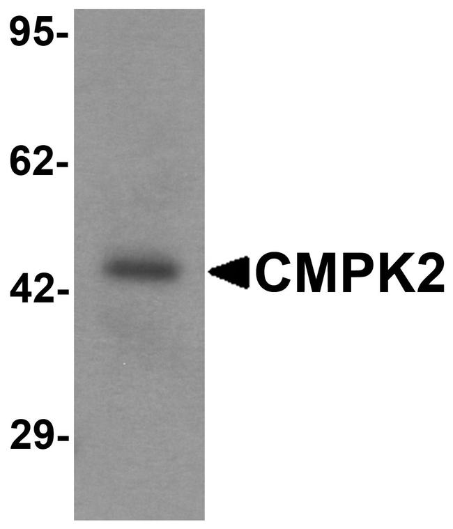 CMPK2 Antibody in Western Blot (WB)