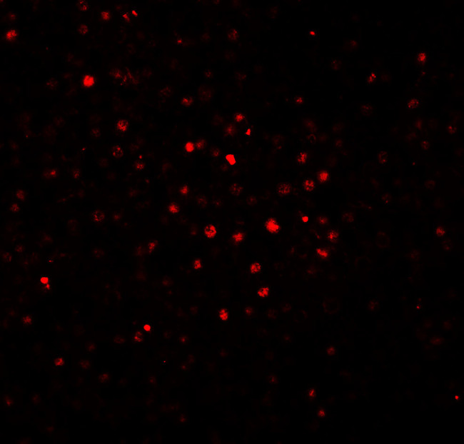 BATF Antibody in Immunohistochemistry (IHC)