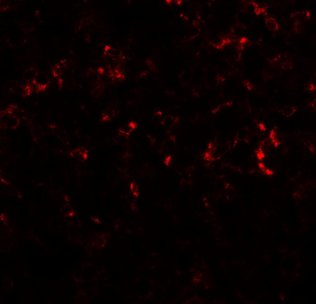 C/EBP delta Antibody in Immunohistochemistry (IHC)