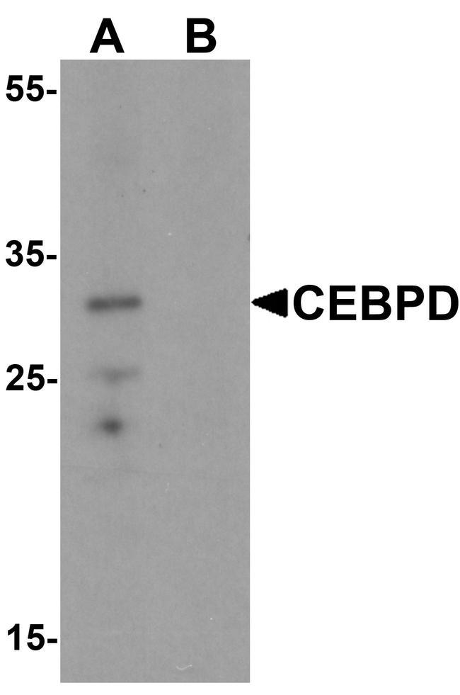 C/EBP delta Antibody in Western Blot (WB)