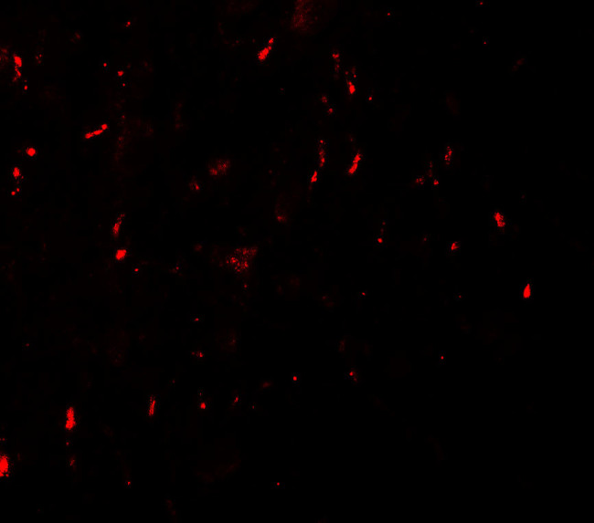 MYT1L Antibody in Immunocytochemistry (ICC/IF)