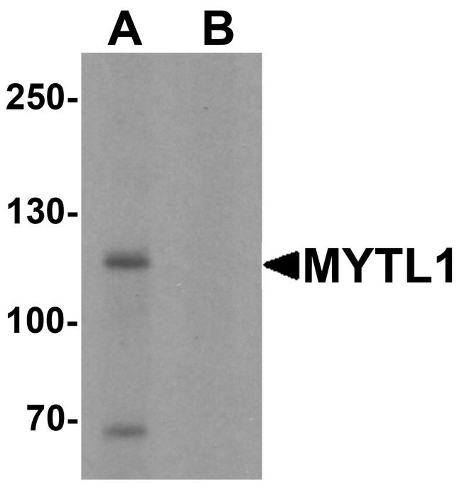 MYT1L Antibody in Western Blot (WB)