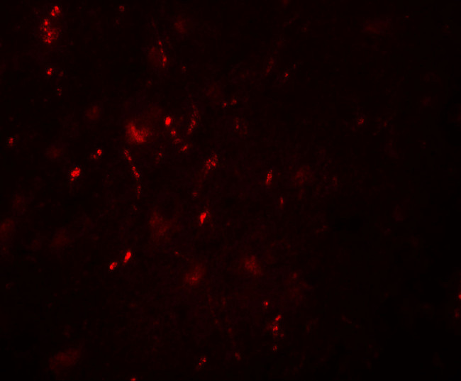 POU3F2 Antibody in Immunohistochemistry (IHC)