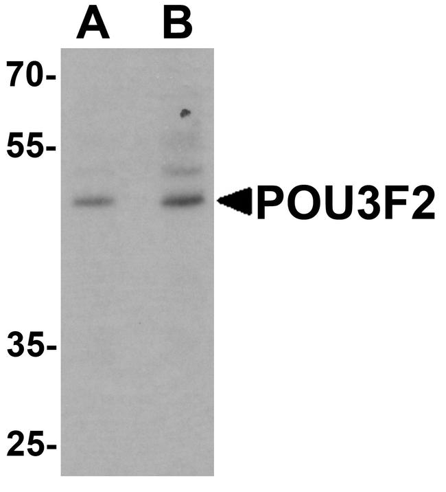 POU3F2 Antibody in Western Blot (WB)