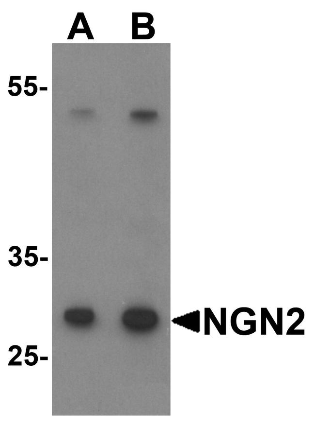 Neurogenin 2 Antibody in Western Blot (WB)