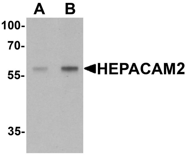 HEPACAM2 Antibody in Western Blot (WB)