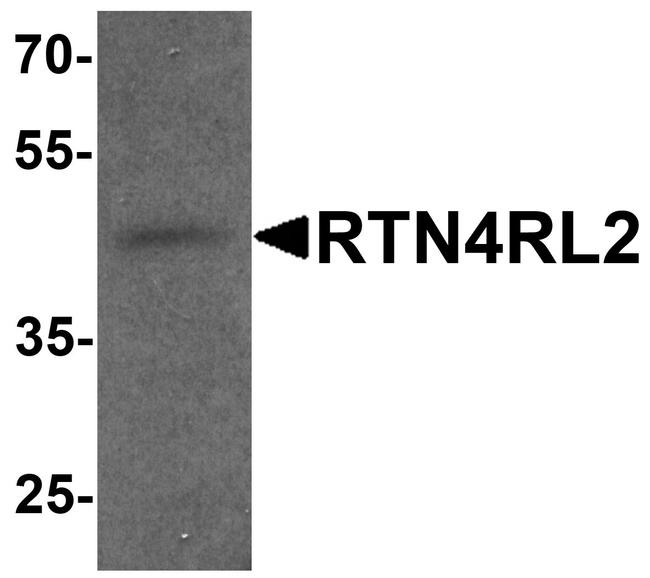 RTN4RL2 Antibody in Western Blot (WB)