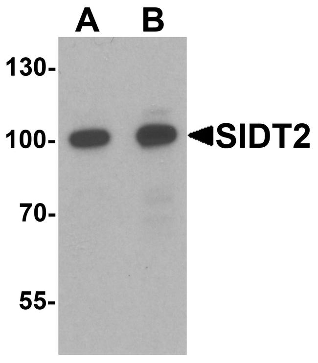 SIDT2 Antibody in Western Blot (WB)