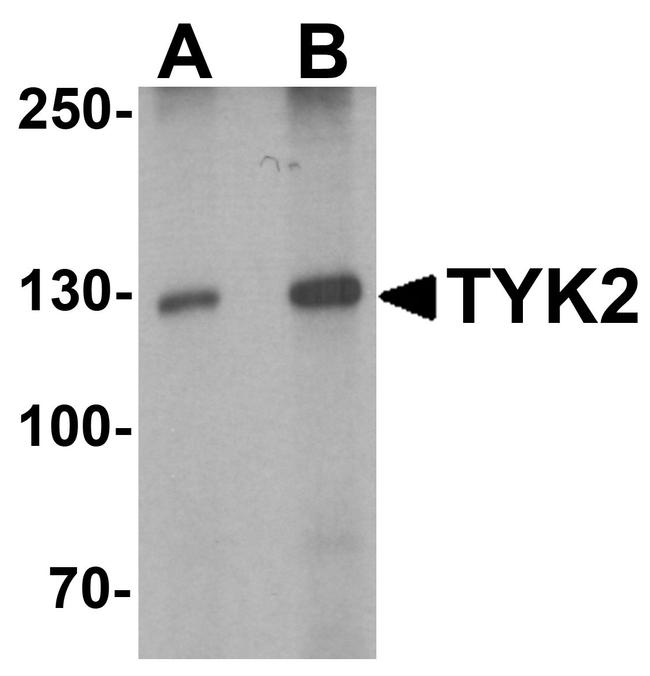 TYK2 Antibody in Western Blot (WB)