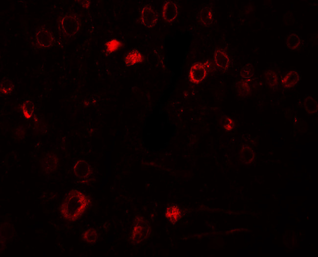 TPT1 Antibody in Immunohistochemistry (IHC)