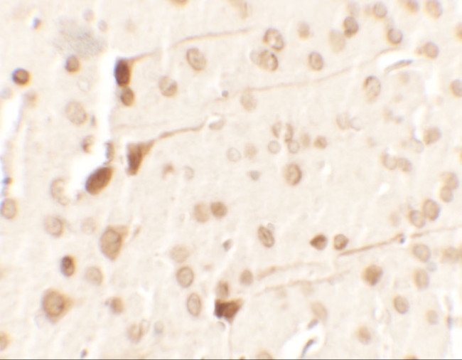 TPT1 Antibody in Immunohistochemistry (IHC)