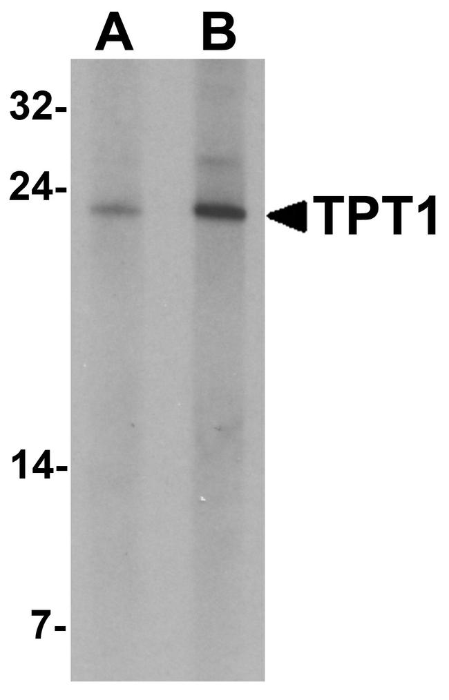 TPT1 Antibody in Western Blot (WB)