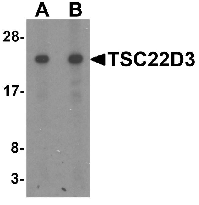 GILZ Antibody in Western Blot (WB)